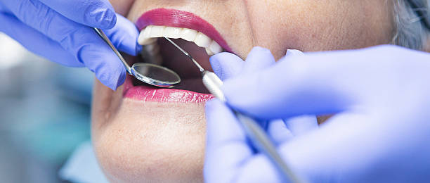 Best Emergency Wisdom Tooth Extraction in Brainerd, MN